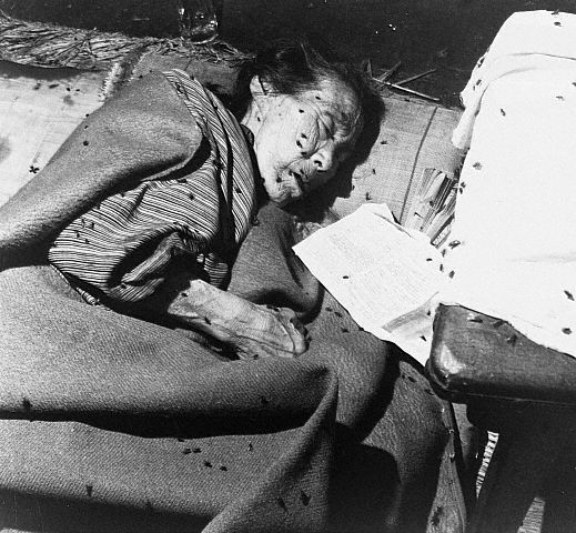 Victim of Hiroshima Bombing